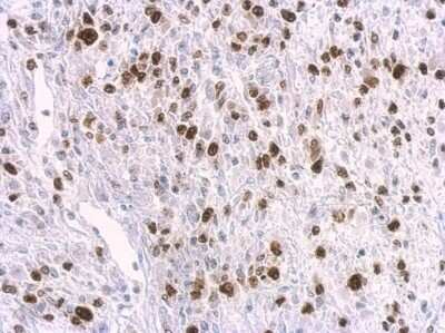Immunohistochemistry-Paraffin: HMGA2 Antibody (763) [NBP2-43640]