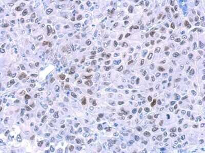 Immunohistochemistry-Paraffin: HMGA2 Antibody (763) [NBP2-43640]