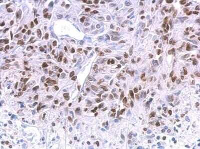 Immunohistochemistry-Paraffin: HMGA2 Antibody (763) [NBP2-43640]