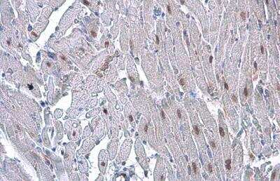 Immunohistochemistry-Paraffin: HMGA2 Antibody (763) [NBP2-43640]