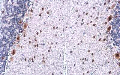 Immunohistochemistry-Paraffin: HMGA2 Antibody (763) [NBP2-43640]