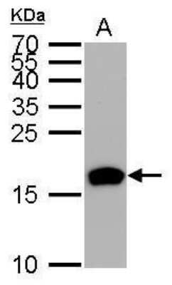 Western Blot: HMGA2 Antibody (763) [NBP2-43640]