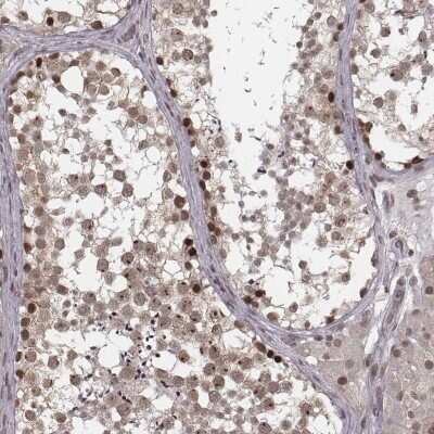 Immunohistochemistry-Paraffin: HMGA2 Antibody [NBP2-48699]