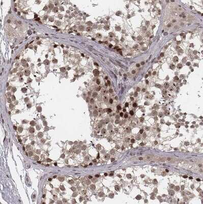Immunohistochemistry-Paraffin: HMGA2 Antibody [NBP2-48699]