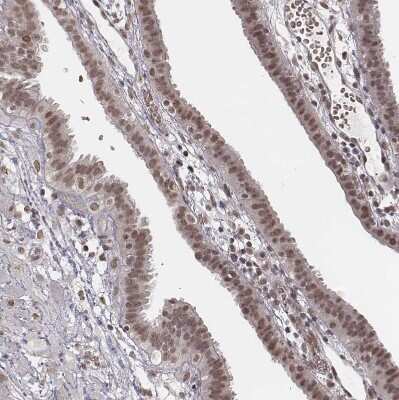 Immunohistochemistry-Paraffin: HMGA2 Antibody [NBP2-48699]