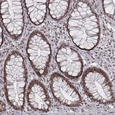 Immunohistochemistry-Paraffin: HMGA2 Antibody [NBP2-48699]