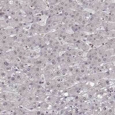 Immunohistochemistry-Paraffin: HMGA2 Antibody [NBP2-48699]