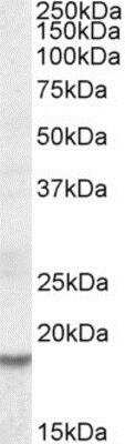 Western Blot: HMGA2 Antibody [NBP1-51985]