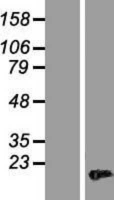 Western Blot: HMGA2 Overexpression Lysate [NBL1-11613]