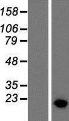 Western Blot: HMGA2 Overexpression Lysate [NBP2-07979]