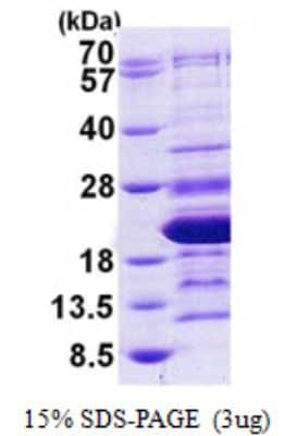 SDS-PAGE: Recombinant Human HMGA2 His Protein [NBP2-23122]