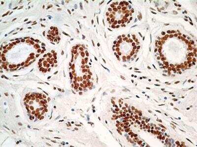Immunohistochemistry: HMGB1/HMG-1 Antibody (19N10B7) - Azide and BSA Free [NBP2-27395]