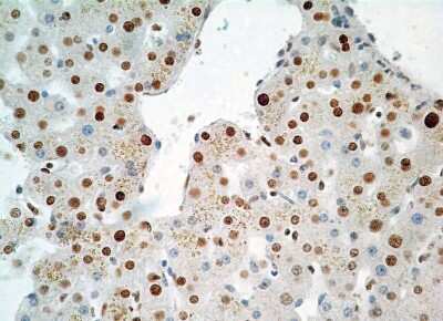 Immunohistochemistry-Paraffin: HMGB1/HMG-1 Antibody (19N10B7) - Azide and BSA Free [NBP2-27395]