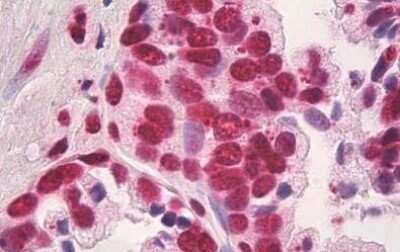 Immunohistochemistry-Paraffin: HMGB1/HMG-1 Antibody (19N10B7) - Azide and BSA Free [NBP2-27395]