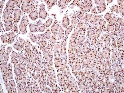 Immunohistochemistry-Paraffin: HMGB1/HMG-1 Antibody (19N10B7) - Azide and BSA Free [NBP2-27395]