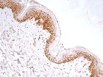 Immunohistochemistry-Paraffin: HMGB1/HMG-1 Antibody (19N10B7) - Azide and BSA Free [NBP2-27395]