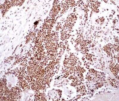 Immunohistochemistry-Paraffin: HMGB1/HMG-1 Antibody (19N10B7) - Azide and BSA Free [NBP2-27395]