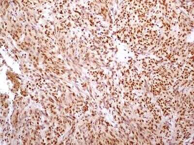 Immunohistochemistry-Paraffin: HMGB1/HMG-1 Antibody (19N10B7) - Azide and BSA Free [NBP2-27395]