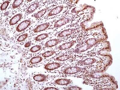 Immunohistochemistry-Paraffin: HMGB1/HMG-1 Antibody (19N10B7) - Azide and BSA Free [NBP2-27395]