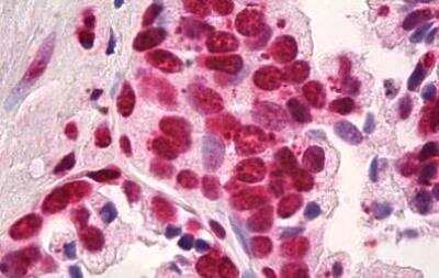 Immunohistochemistry-Paraffin: HMGB1/HMG-1 Antibody (19N10B7) - BSA Free [NBP2-27396]