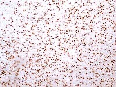 Immunohistochemistry-Paraffin: HMGB1/HMG-1 Antibody (19N10B7) - BSA Free [NBP2-27396]