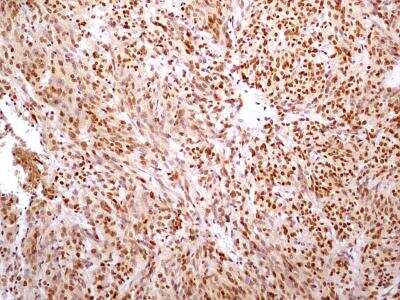 Immunohistochemistry-Paraffin: HMGB1/HMG-1 Antibody (19N10B7) - BSA Free [NBP2-27396]