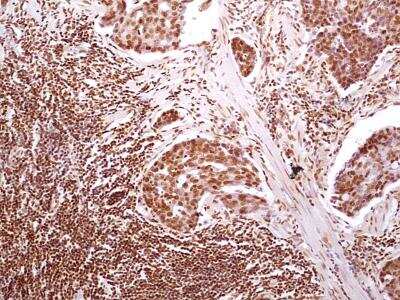 Immunohistochemistry-Paraffin: HMGB1/HMG-1 Antibody (19N10B7) - BSA Free [NBP2-27396]