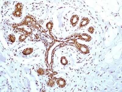 Immunohistochemistry: HMGB1/HMG-1 Antibody (19N15F4) - Azide and BSA Free [NBP2-80775]