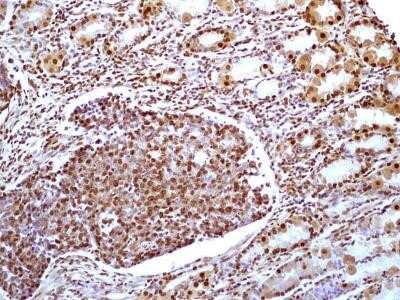 Immunohistochemistry: HMGB1/HMG-1 Antibody (19N15F4) - Azide and BSA Free [NBP2-80775]