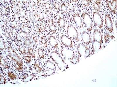 Immunohistochemistry: HMGB1/HMG-1 Antibody (19N15F4) - Azide and BSA Free [NBP2-80775]