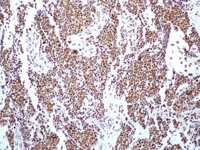 Immunohistochemistry: HMGB1/HMG-1 Antibody (19N15F4) - Azide and BSA Free [NBP2-80775]