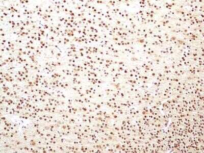 Immunohistochemistry: HMGB1/HMG-1 Antibody (19N15F4) - Azide and BSA Free [NBP2-80775]