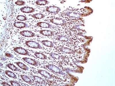 Immunohistochemistry-Paraffin: HMGB1/HMG-1 Antibody (19N15F4) - Azide and BSA Free [NBP2-80775]