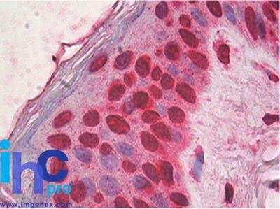 Immunohistochemistry-Paraffin: HMGB1/HMG-1 Antibody (19N15F4) [NBP2-27401]