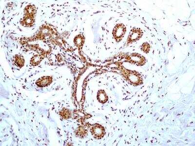 Immunohistochemistry-Paraffin: HMGB1/HMG-1 Antibody (19N15F4) [NBP2-27401]