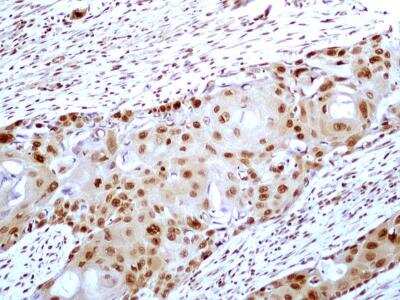 Immunohistochemistry-Paraffin: HMGB1/HMG-1 Antibody (19N15F4) [NBP2-27401]