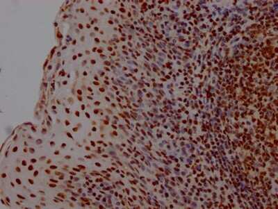 Immunohistochemistry: HMGB1/HMG-1 Antibody (1A1) [NBP3-15235]