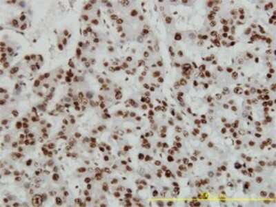 Immunohistochemistry-Paraffin: HMGB1/HMG-1 Antibody (1D5) [H00003146-M02]
