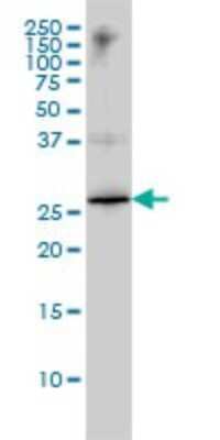 Western Blot: HMGB1/HMG-1 Antibody (1D5) [H00003146-M02]