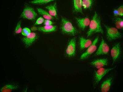 Immunocytochemistry/ Immunofluorescence: HMGB1/HMG-1 Antibody (1F3) [NBP2-25148]