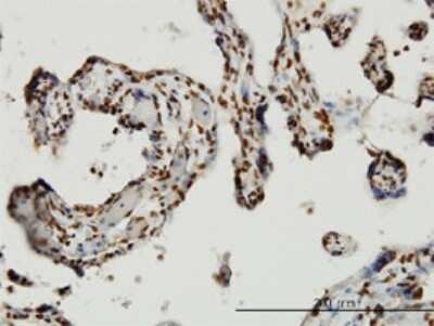 Immunohistochemistry-Paraffin: HMGB1/HMG-1 Antibody (2F6) [H00003146-M08]