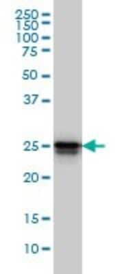 Western Blot: HMGB1/HMG-1 Antibody (2F6) [H00003146-M08]