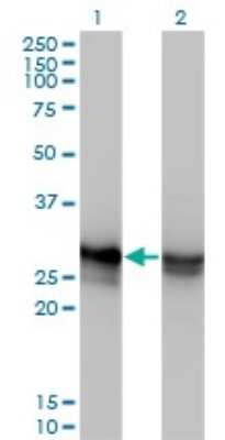 Western Blot: HMGB1/HMG-1 Antibody (2F6) [H00003146-M08]