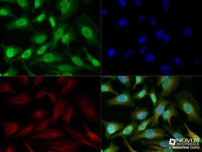 Immunocytochemistry/ Immunofluorescence: HMGB1/HMG-1 Antibody [NB100-2322]