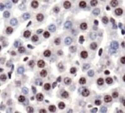 Immunohistochemistry-Paraffin: HMGB1/HMG-1 Antibody [NB100-2322]