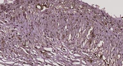 Immunohistochemistry-Paraffin: HMGB1/HMG-1 Antibody [NB100-2322]