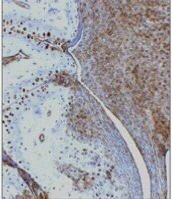 Immunohistochemistry-Paraffin: HMGB1/HMG-1 Antibody [NBP2-27117]