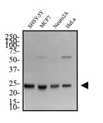 Western Blot: HMGB1/HMG-1 Antibody [NB100-2322]