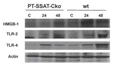 Western Blot: HMGB1/HMG-1 Antibody [NB100-2322]