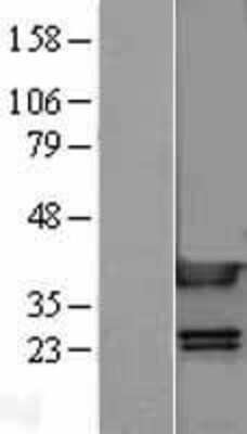 Western Blot: HMGB1/HMG-1 Overexpression Lysate [NBL1-11614]